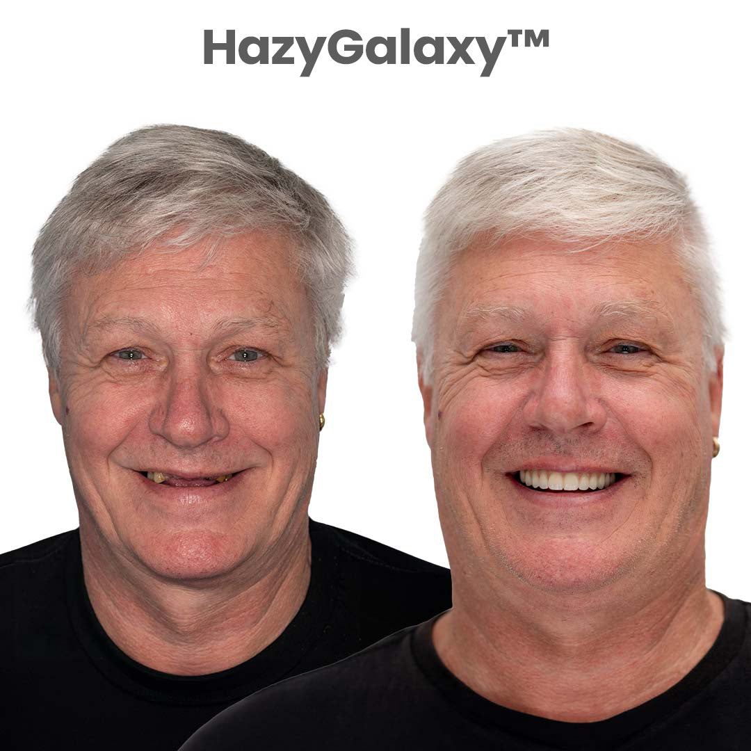 '--🦷 HazyGalaxy™ Custom-Fit Dentures ⏰ ENDS TODAY 75% OFF | Smile with Confidence