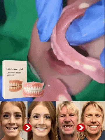 Ends Today: 76% OFF! 🦷[Epic Upgrade] Premium Full Cover Dentures🦷