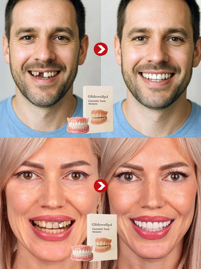 Ends Today: 76% OFF! 🦷[Epic Upgrade] Premium Full Cover Dentures🦷