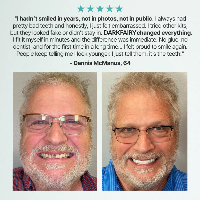 🌎🏆Ends Today: 78% OFF! 🏆2026 Bestselling Product🦷 Fit for a Fresh Smile, Say Goodbye to Wearing Discomfort!