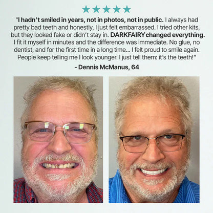 🌎🏆Ends Today: 78% OFF! 🏆2026 Bestselling Product🦷 Fit for a Fresh Smile, Say Goodbye to Wearing Discomfort!