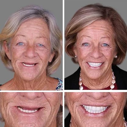 '--Ends Today: 75% OFF! ⏰DarkFairy™ Medical Full Denture with Strong Suctiond Custom-Fit Full Functional Dentures🦷