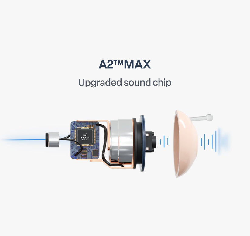 🔥 Today Only! DarkFairy™ Atom X Smart Hearing Aids — Hear Clearly, Feel Confident Again 💖